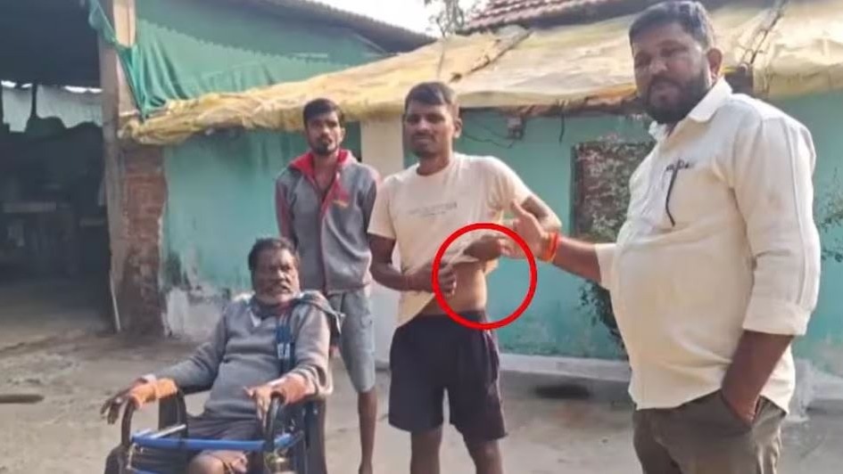 50 हजार का कर्ज, 74 लाख की वसूली! किसान को लोन के लिए बेचनी पड़ी किडनी, जांच में अंग निकालने की पुष्टि