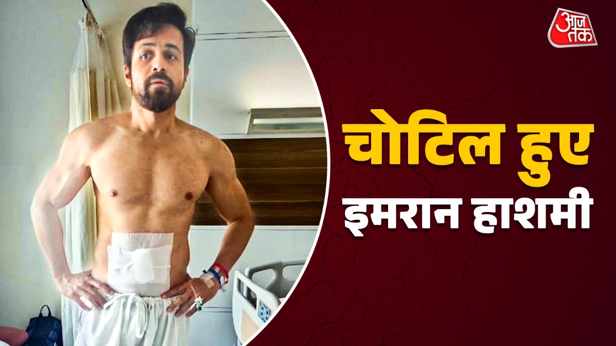 Emraan Hashmi injured during Awarapan 2 shooting