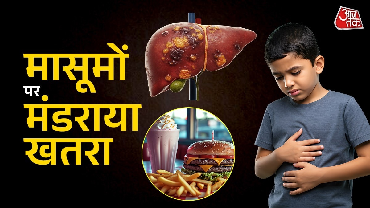 fatty liver in kids