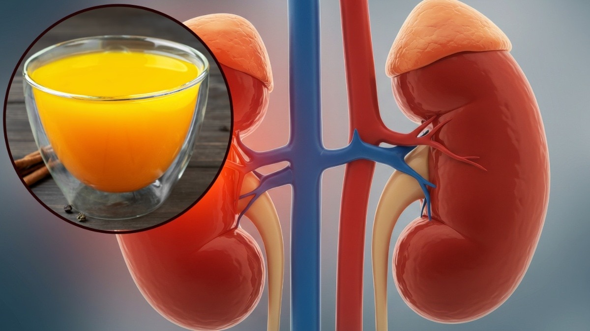 किडनी को हेल्दी रखती है ये ड्रिंक (Photo: ITG)