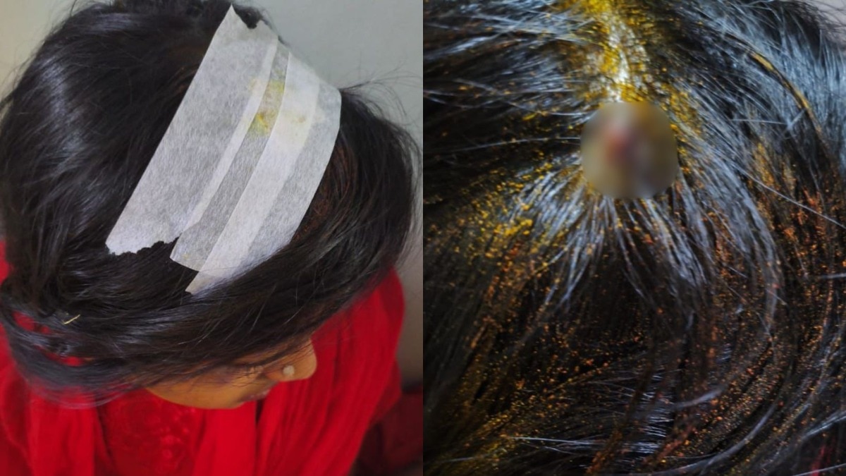 Bengaluru Stone Pelting