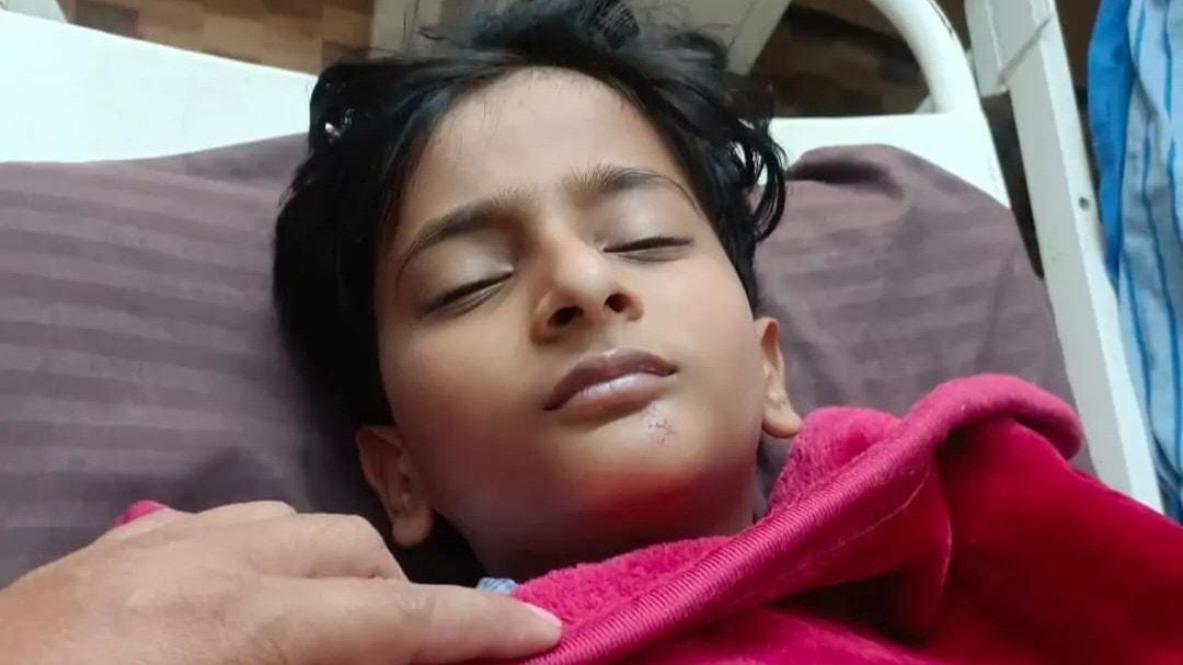 ऑटो चढ़ने से गंभीर रूप से घायल बच्चा. (Photo: Nitin Srivastava/ITG)