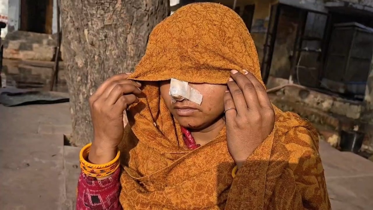 पीड़िता पूनम.(Photo: Umesh Mishra/ITG)