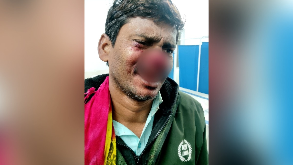 बड़ा भाई, जिसकी चचेरे भाई ने तलवार से नाक काट दी. (Photo: Screengrab)