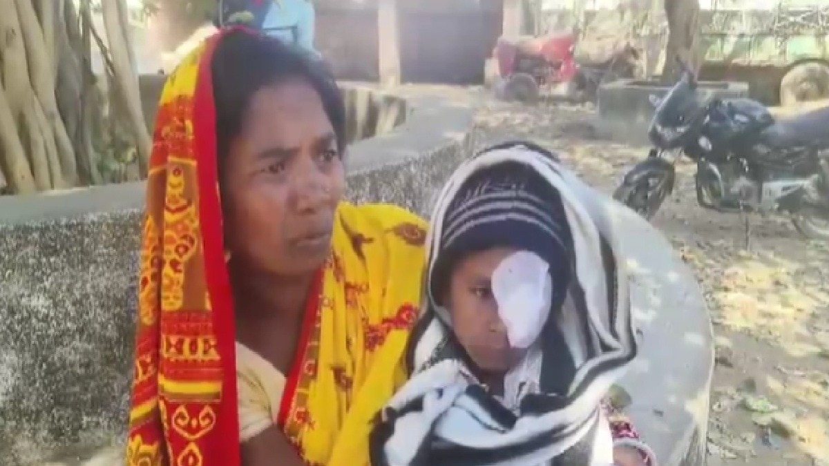 Kid loses eye sight