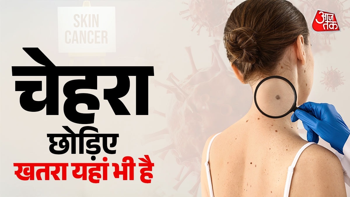 Skin Cancer (Photo: ITG)