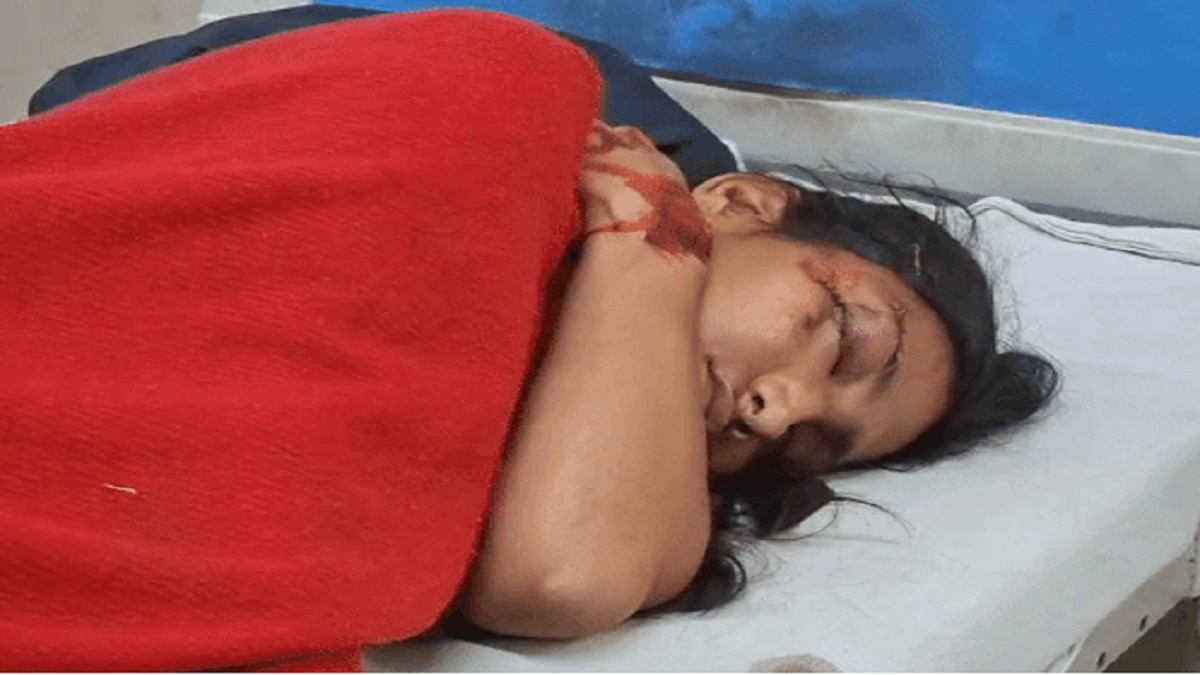 छात्रा के दोस्त को भी चोट लगी है. (Photo: Screengrab)