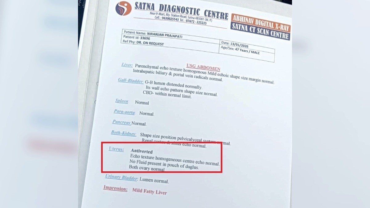 सतना डायग्नोस्टिक सेंटर ने पुरुष को बताया 'प्रेग्नेंट' होने की श्रेणी वाली रिपोर्ट.(Photo:ITG)