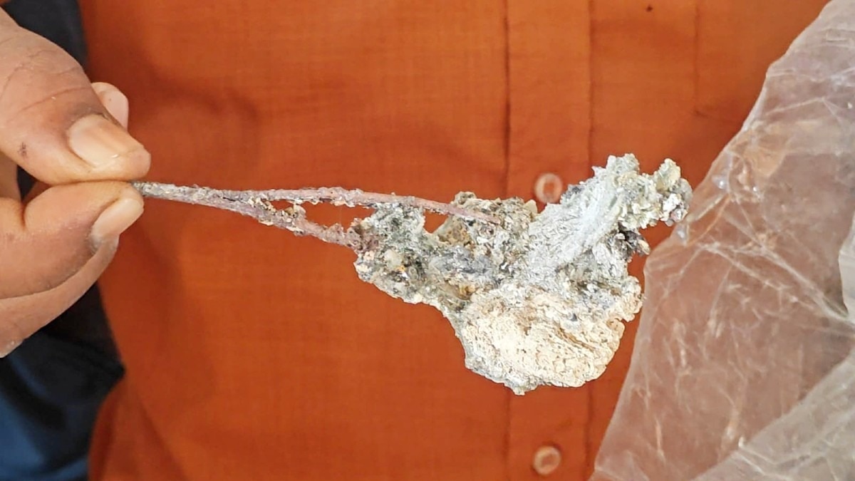 Sehore Medical Negligence Scissors Case