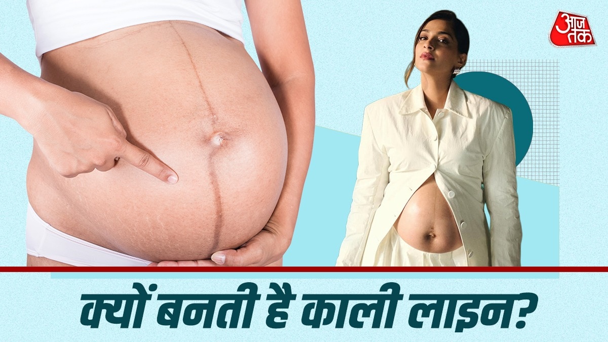 What is dark line visible on Sonam Kapoor stomach?