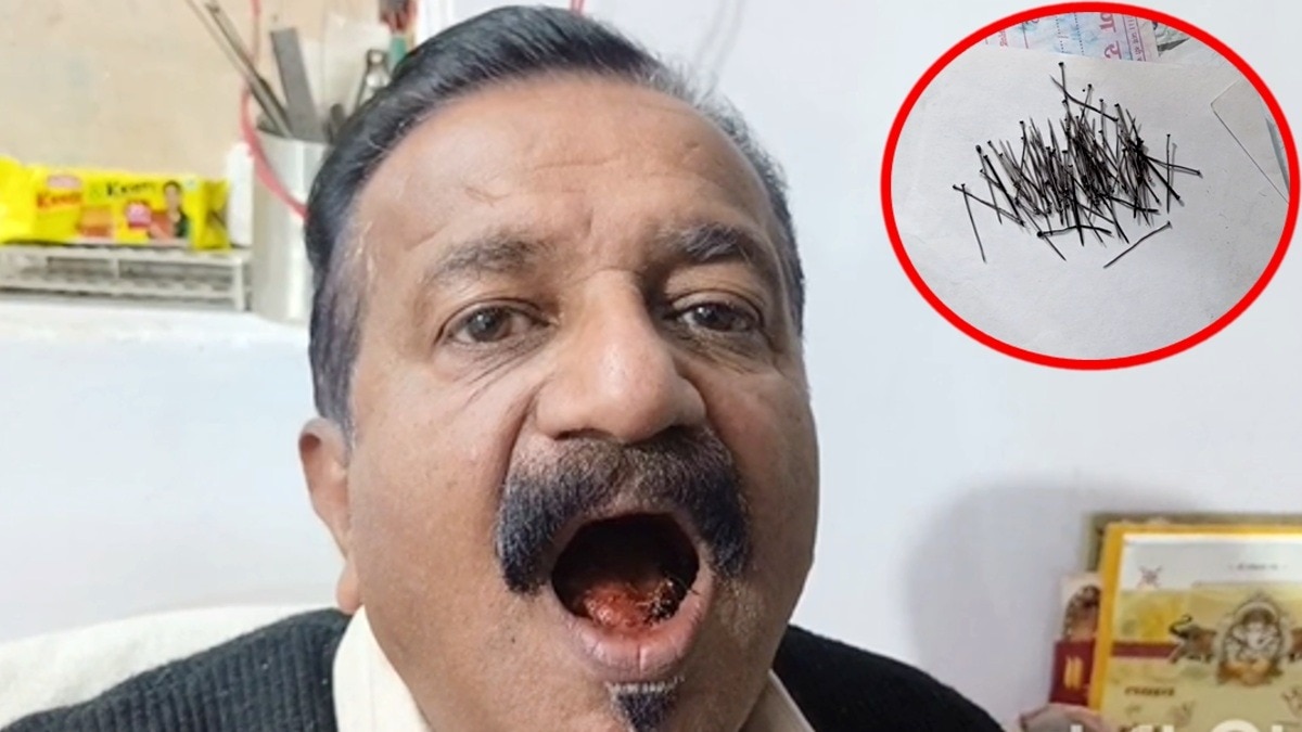 सतना के संजय विश्वकर्मा के गालों में छिपी हैं 150 नुकीली पिनें.(Photo:ITG)