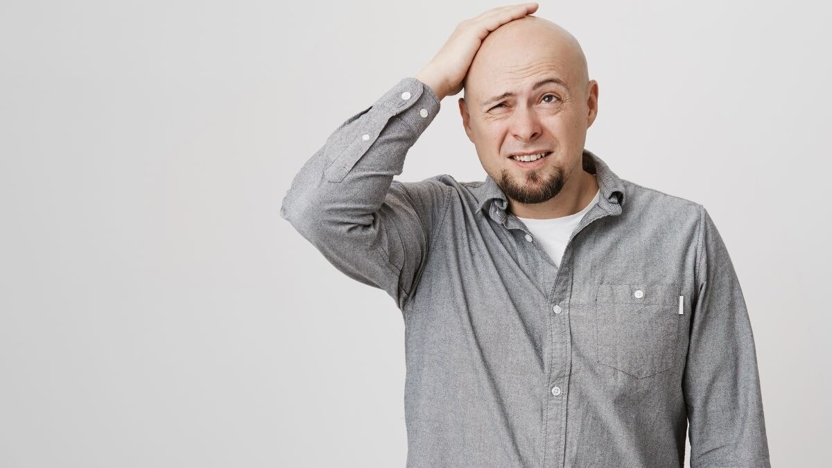 गंजापन पुरुष और महिला दोनों में बढ़ रहा है. (Photo: ITG)