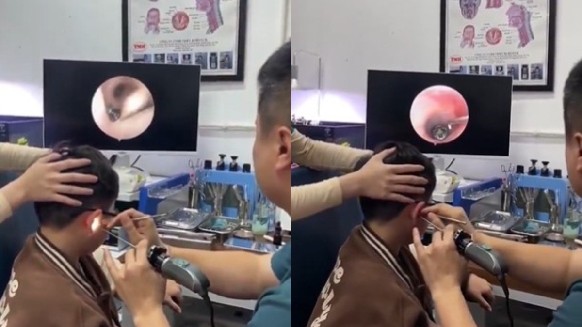 Vietnam child ear screw, child ear pain viral video,