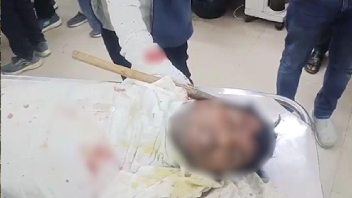 बहन की शादी में भाई पर हमला, सिर में धंसी कुल्हाड़ी लेकर पहुंचा अस्पताल