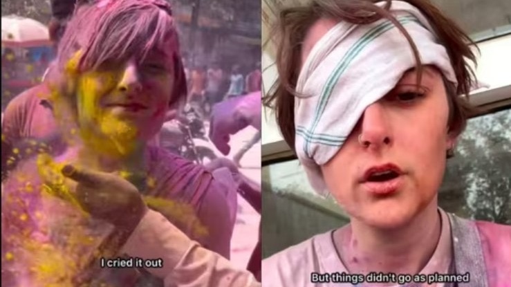 महिला का कहना है कि होली खेलते समय किसी ने रंग के साथ छोटे पत्थर उठाकर उनकी आंखों में फेंक दिए. ( Photo: Instagram/@breeandthelove)