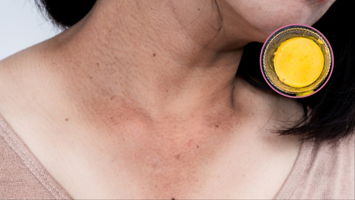 चेहरा चमकता है पर गर्दन काली दिखती है? इन 3 घरेलू उपायों से दूर होगी समस्या (Photo- Adobe stock, Getty image)