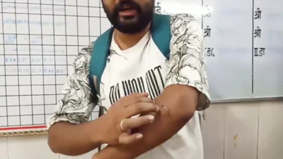  अस्पताल में मरीज ने बुलाई पुलिस (Photo: itg)