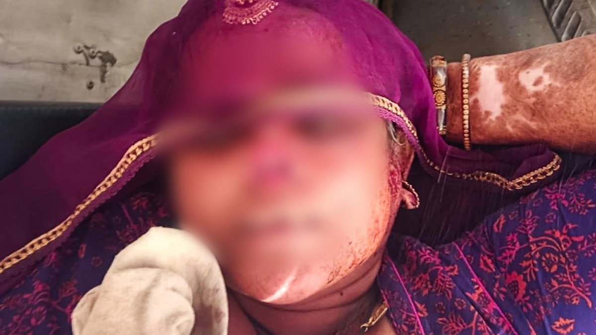 son-in-law-cuts-mother-in-law-nose-with-scissors jalore LCLAR 