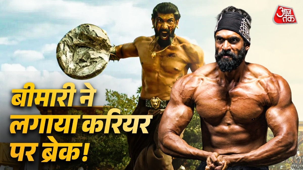 World Kidney Day Rana Daggubati 