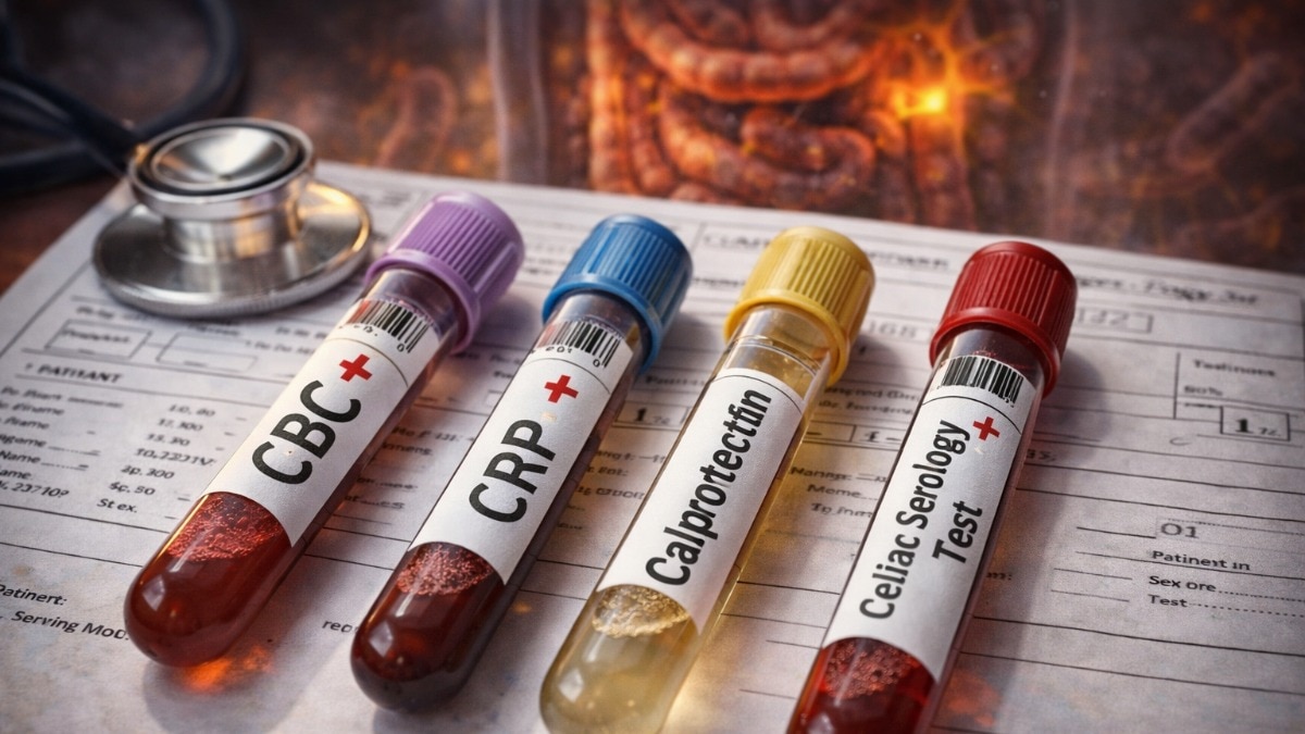 4-tests-for-stomach-health