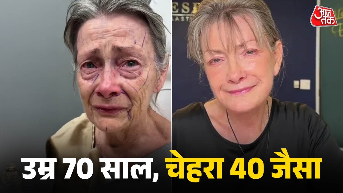 Before and After face Transformation