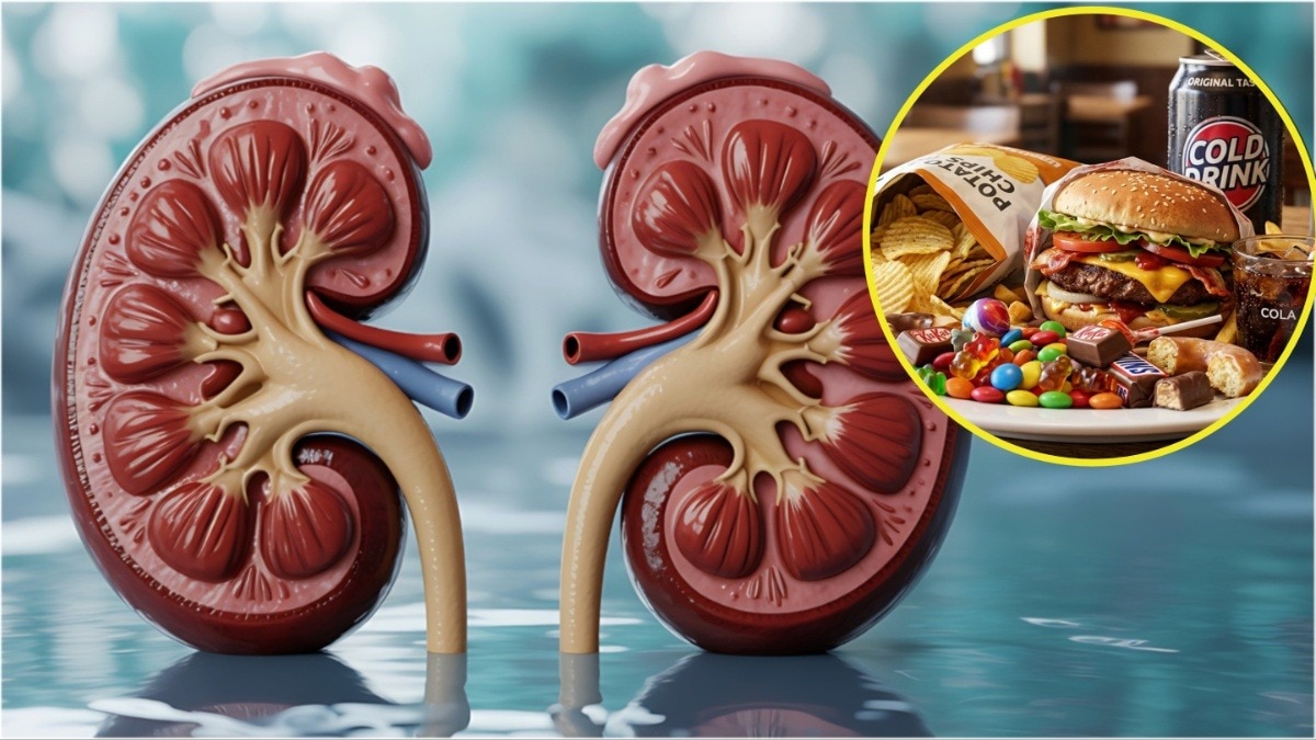 5 worst foods for kidney 