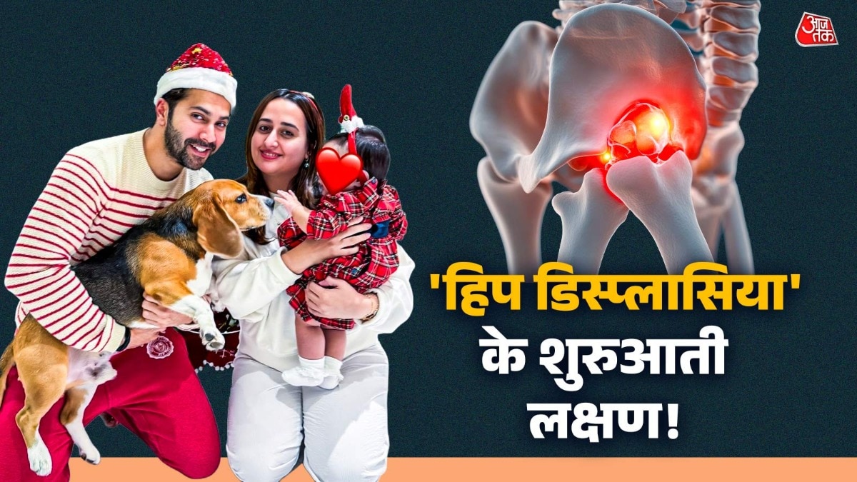 Developmental Dysplasia of the Hip