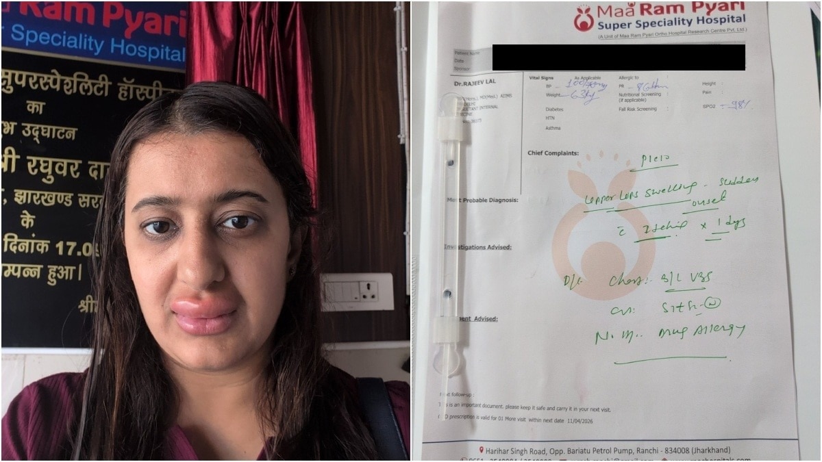 महिला ने सोशल मीडिया पर अपनी तस्वीरें और डॉक्टर की पर्ची भी शेयर की है (Photo:X/@AyushiS54377868)
