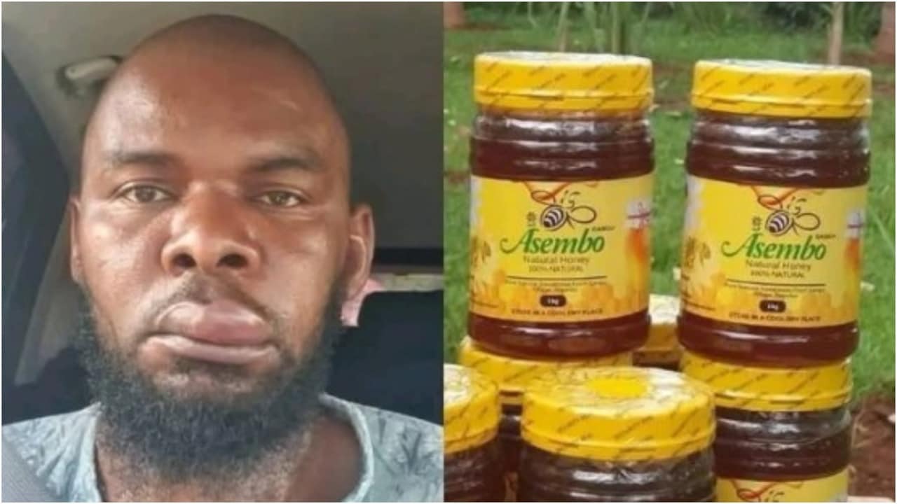 मधुमक्खियों के डंक से सूजा चेहरा, उसी फोटो से शहद बेचकर वायरल हुआ शख्स