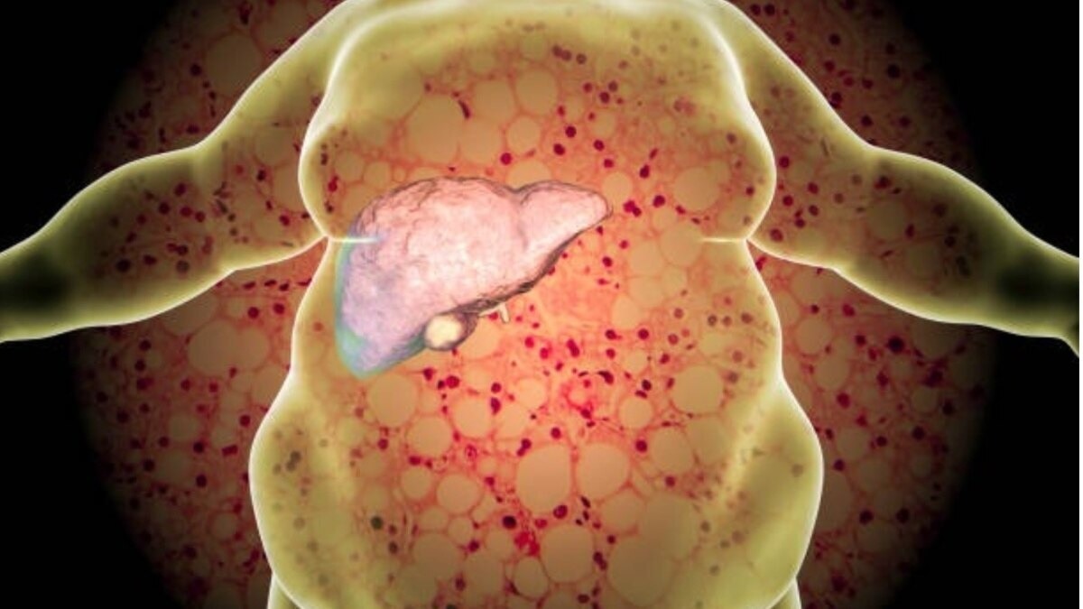 भारत में कम उम्र के लोगों में भी लिवर की बीमारियां बढ़ रही हैं. (Photo: ITG)