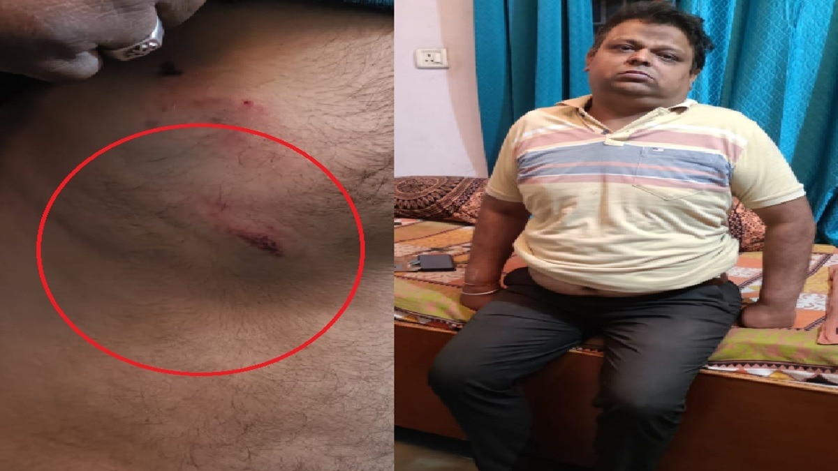 भालू के हमले में घायल हुआ कर्मचारी. (Photo: Screengrab)