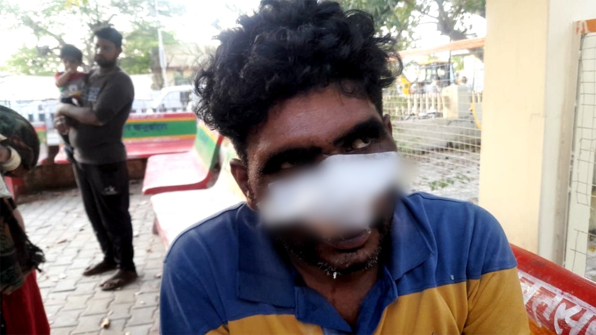 अजमेर कोर्ट का फैसला, पति-पत्नी की नाक काटने वालों को सुनाई 3 साल की सजा