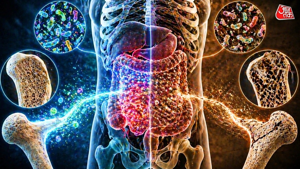 पेट की हेल्थ आपकी बोन हेल्थ से जुड़ी हुई है. (Photo: AI Generated)