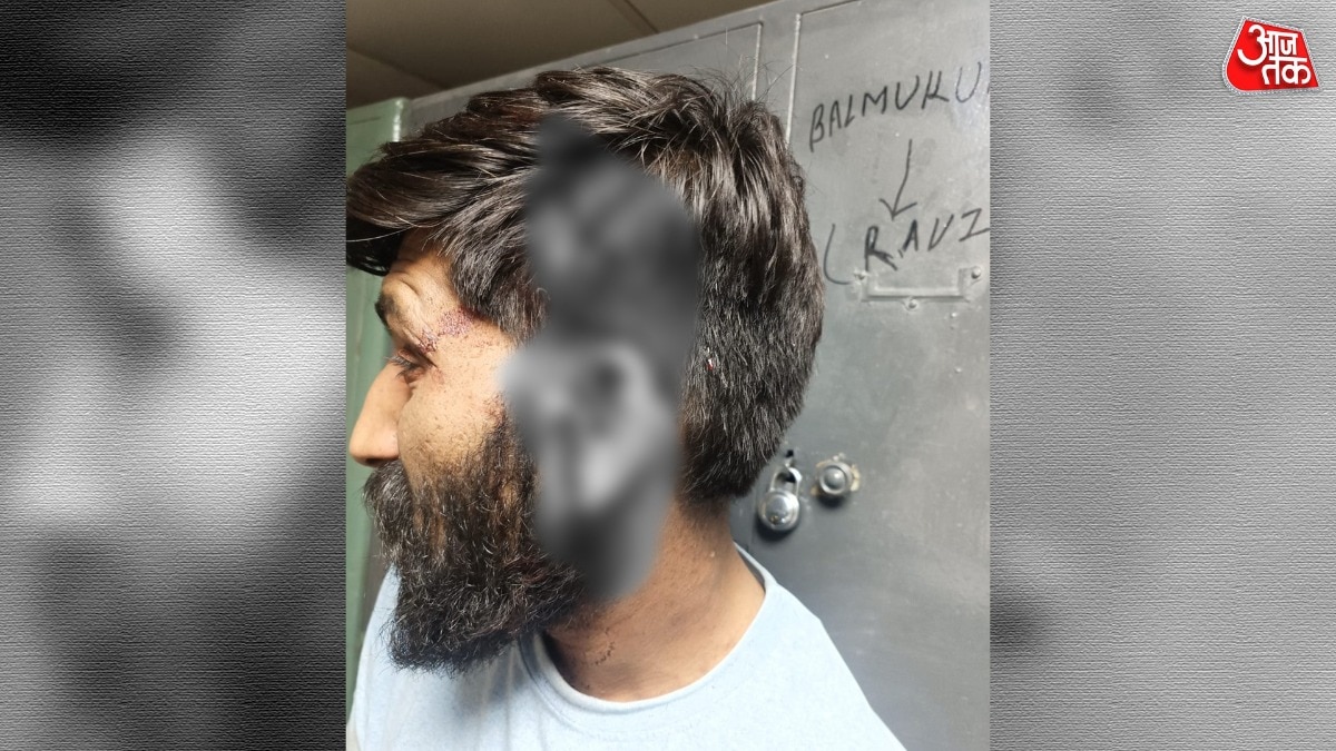 पेशाब करने के विवाद में 2 युवकों की बुरी तरह पिटाई, लगाने पड़े 35 टांके