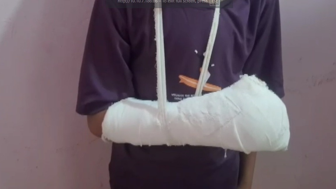 स्कूल के शिक्षक ने कक्षा 7वीं के बच्चे को पीटा. (Photo : ITG)