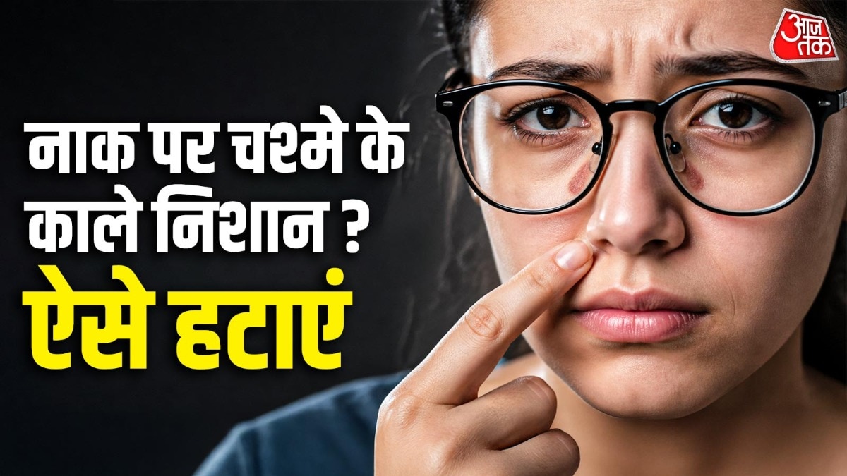 चश्मे से बने जिद्दी नोज मार्क्स लुक बिगाड़ देते हैं. (Photo: ITG)