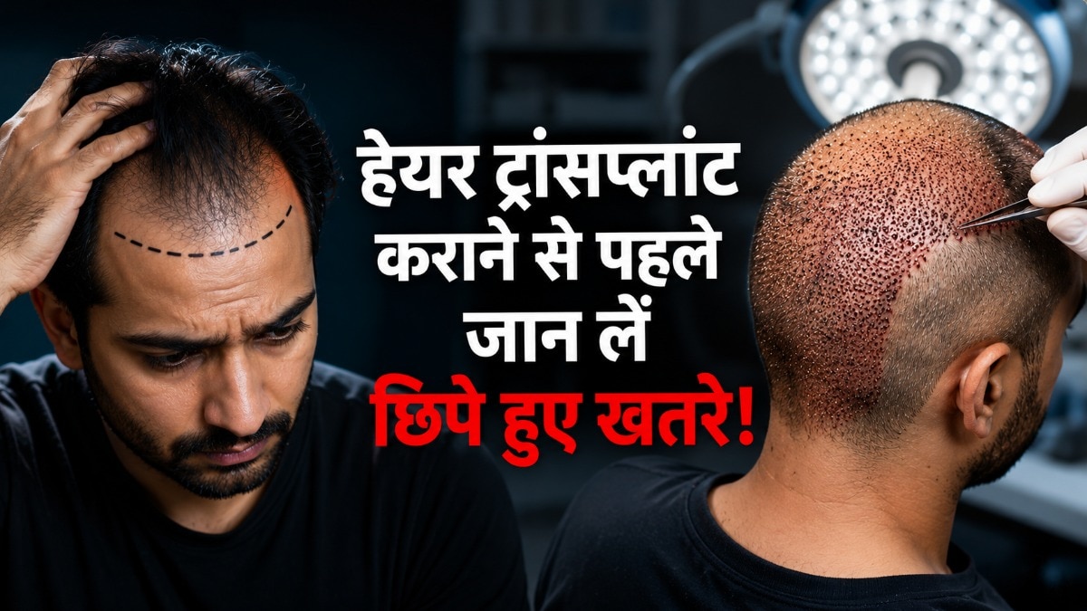 हेयर ट्रांसप्लांट कराने जा रहे हैं? पहले जान लें ये 5 गंभीर साइड इफेक्ट्स