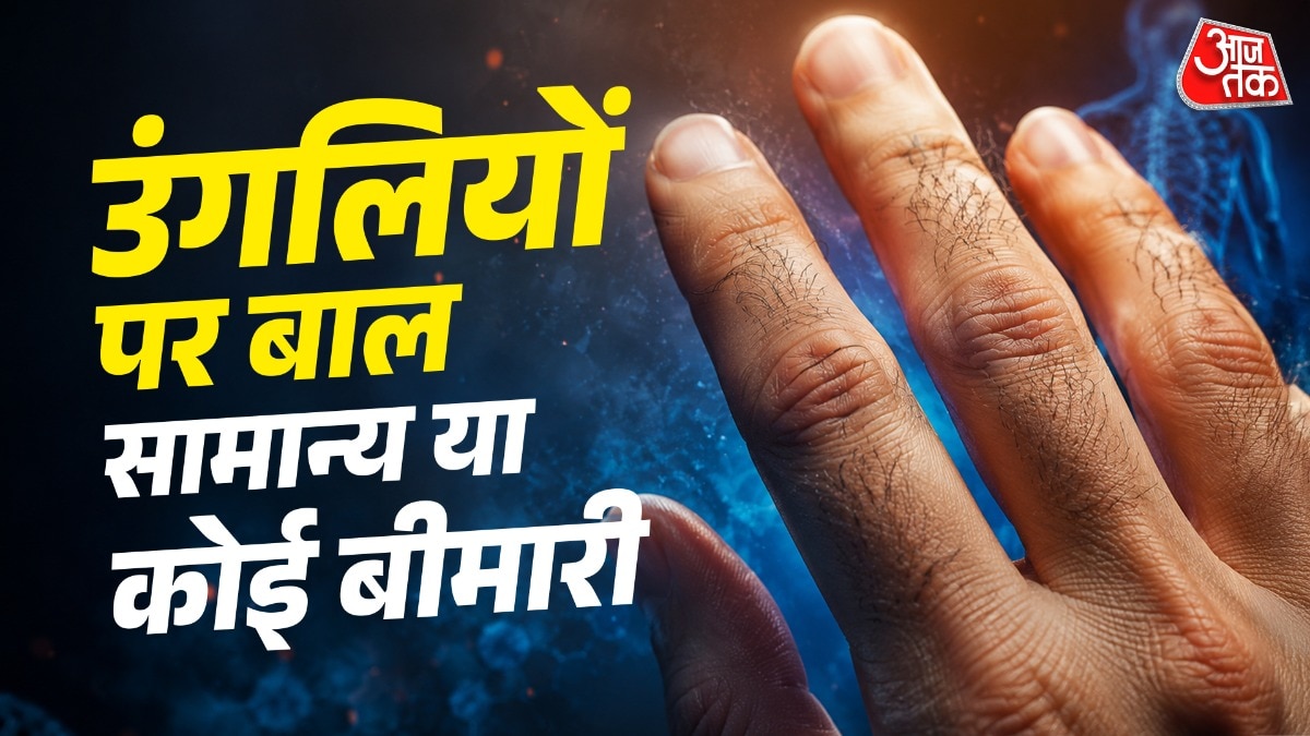 कुछ लोगों की उंगुलियों पर घने बाल आ जाते हैं. (Photo: AI Generated)