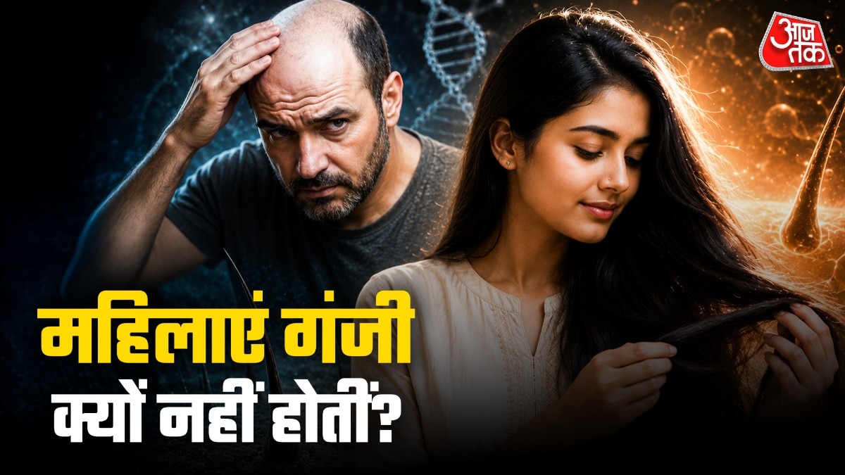 6a0709ef5ad61-male-pattern-baldness--female-hair-loss-155625871-16x9.jpeg