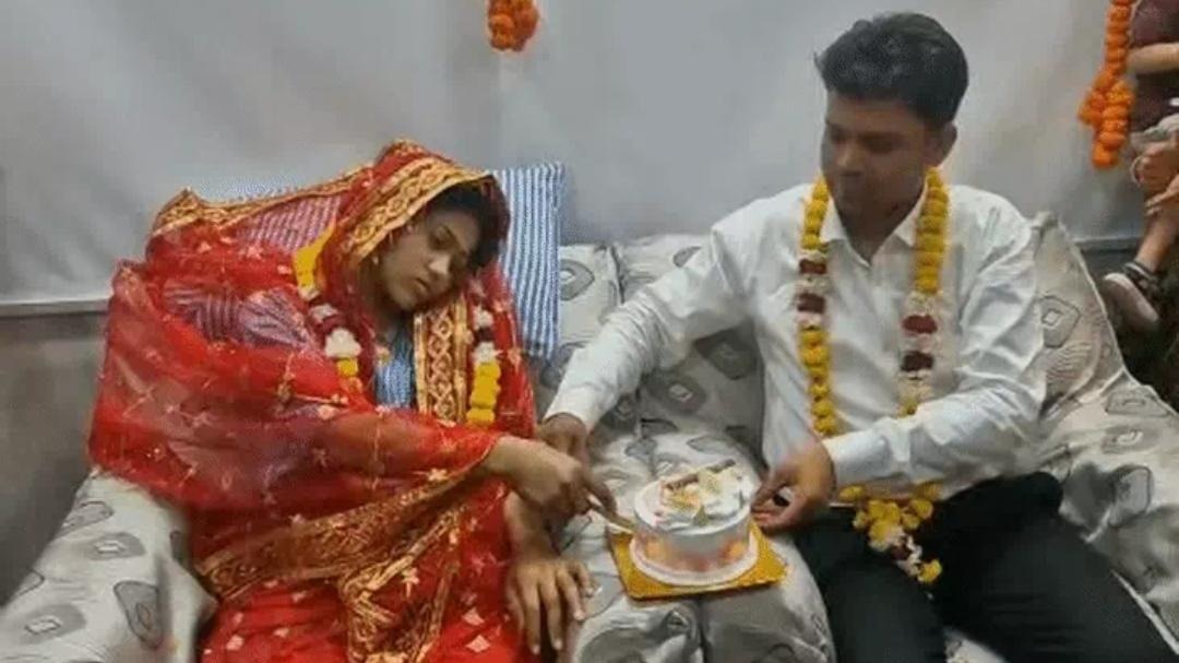आग में झुलसी दुल्हन, अस्पताल बना मंडप... बर्न वार्ड में दूल्हे ने भरी मांग