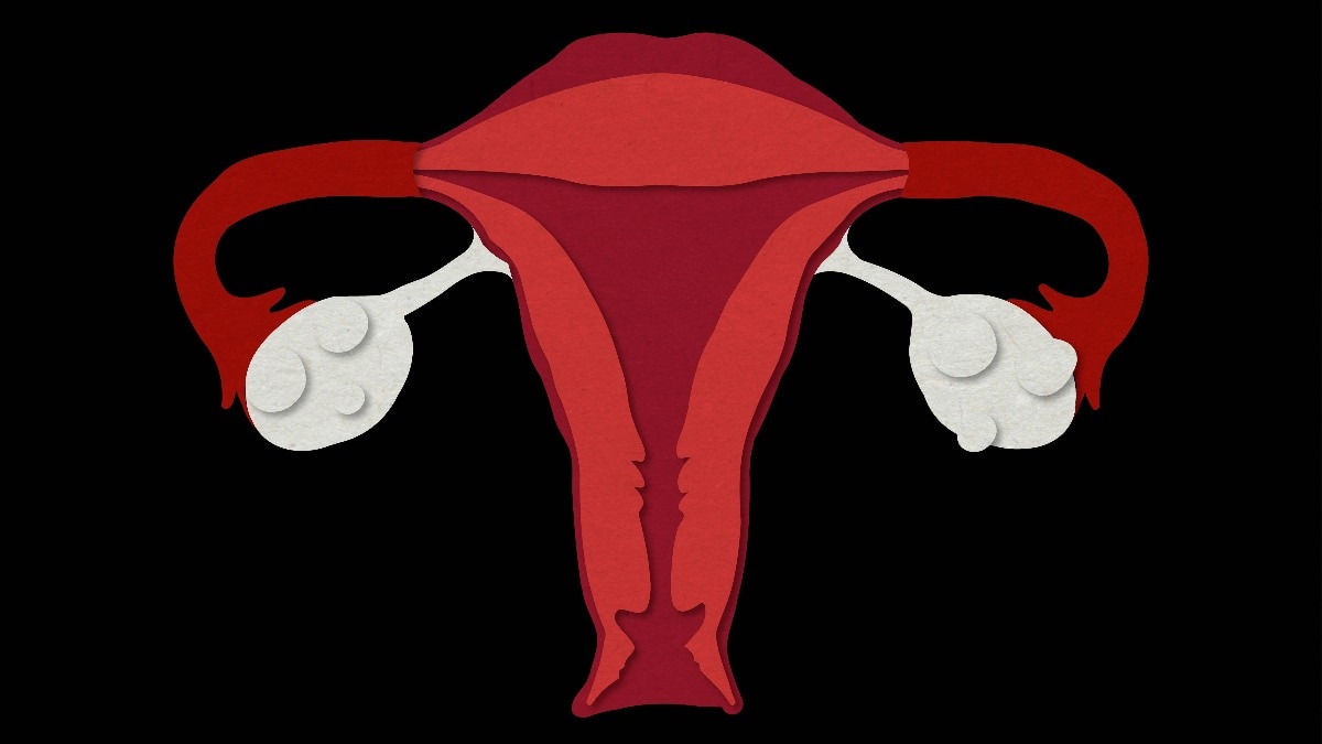 New Trend in Contraception