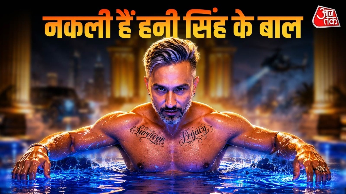 Yo Yo Honey Singh completely bald