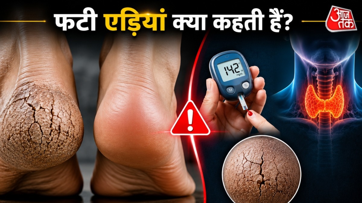 क्या आपकी एड़ियां बार-बार फटती हैं? इन छिपी बीमारियों का हो सकता है इशारा