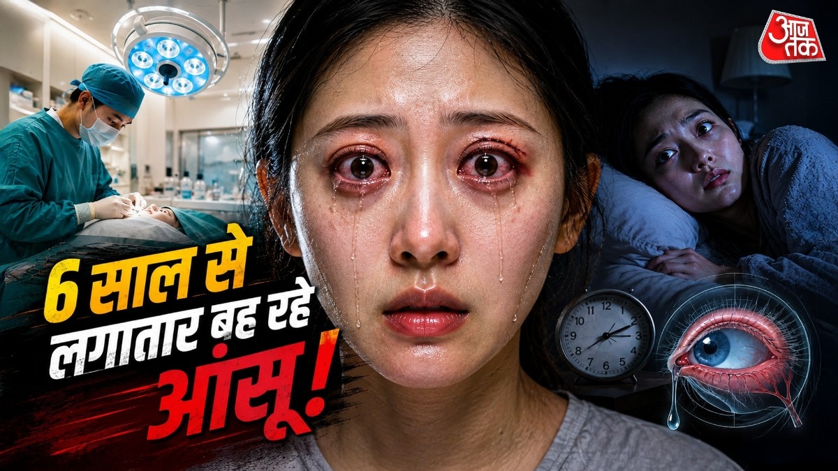 सर्जरी के बाद उसकी टियर ग्लैंड को नुकसान पहुंचा, जिससे उसकी आंखों से लगातार आंसू बहते रहते हैं. ( Photo: ITG)
