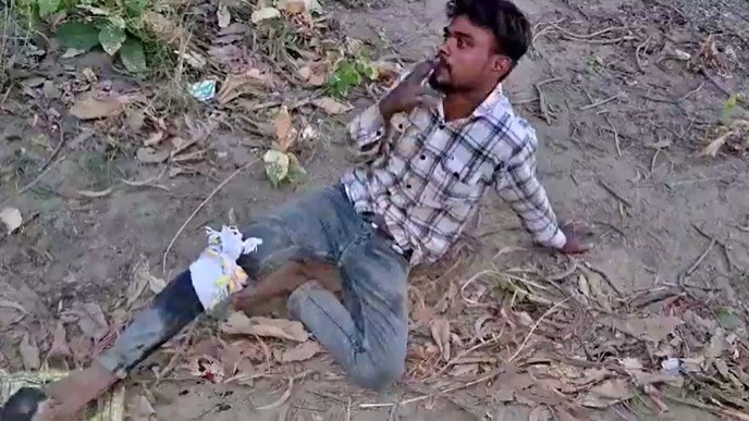 एकाउंटर के बाद बीड़ी मांग रहा बदमाश (Photo- Screengrab