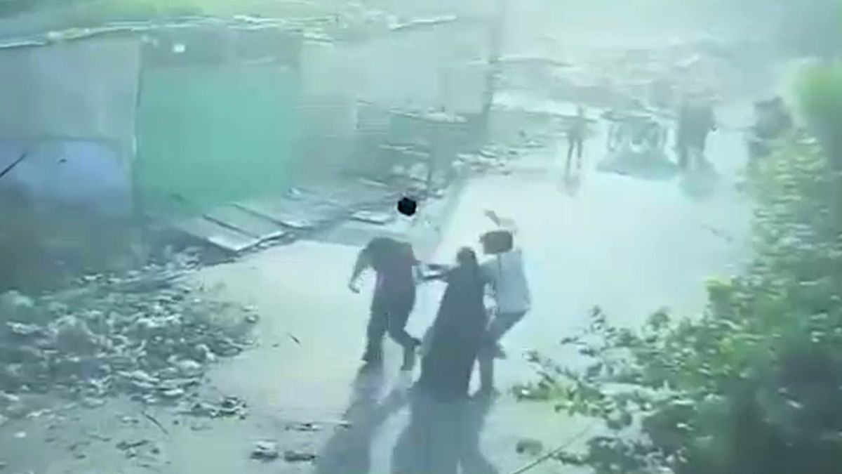 लड़की की गर्दन, चेहरे, पीठ और हाथों पर किए वार. (Photo: Screengrab)