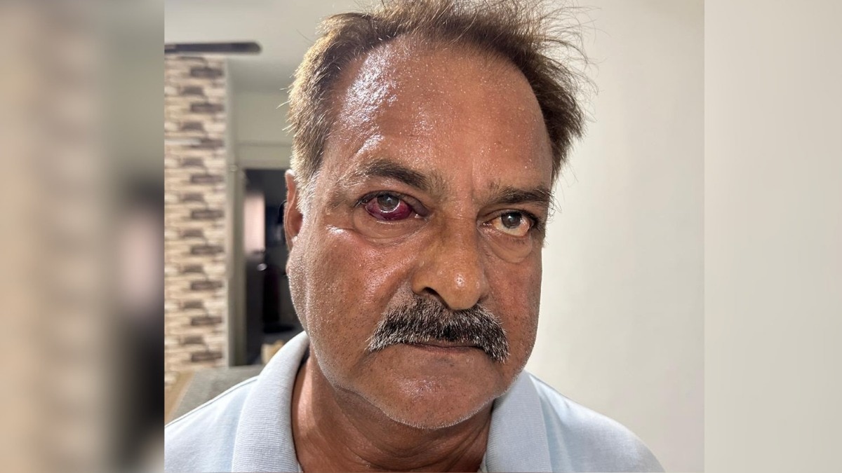 दूसरे थाने में पहुंचकर दिव्यांग को पीटा.(Photo: Atul Tiwari/ITG)
