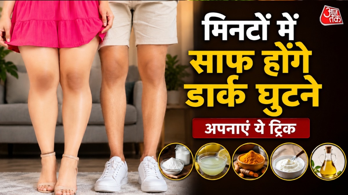 गर्मियों में कई बार घुटने के डार्क कलर के कारण शॉर्ट ड्रेस या शॉर्ट्स पहनने से कतराते हैं, (Photo: AI Generated)