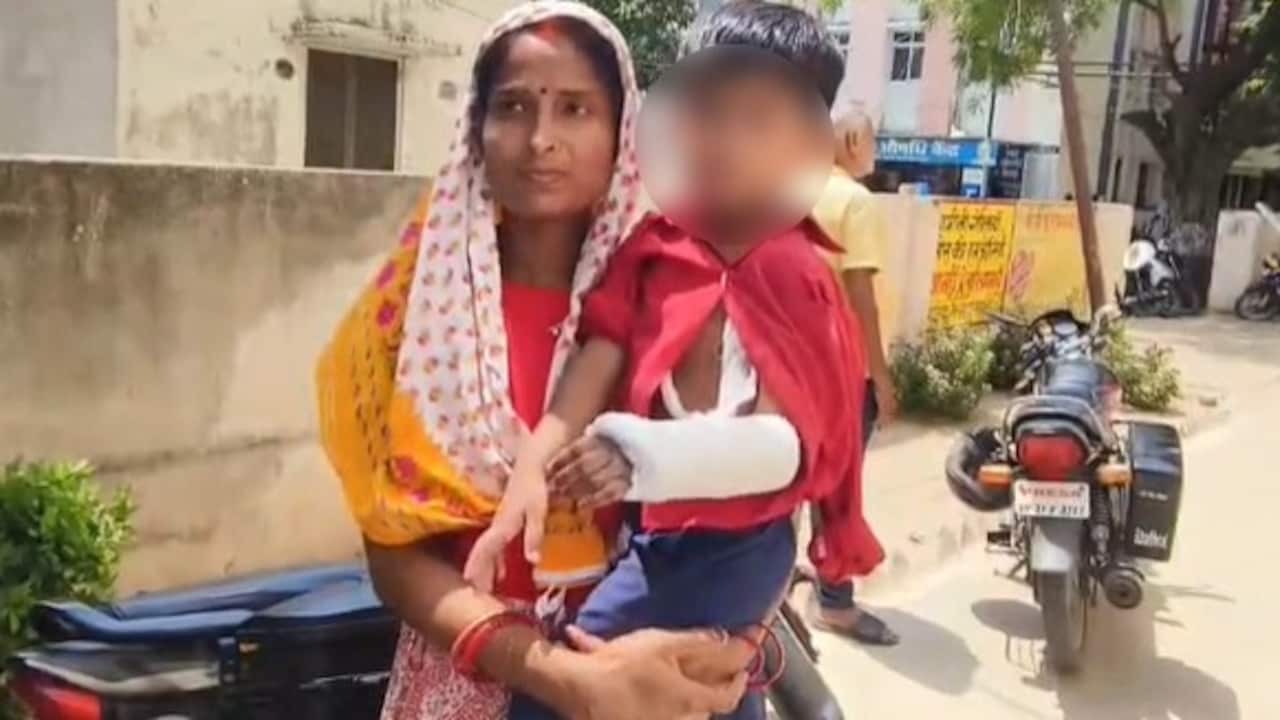 बच्ची के दाहिने हाथ में था फ्रैक्चर, डॉक्टरों ने बाएं हाथ पर चढ़ा दिया प्लास्टर