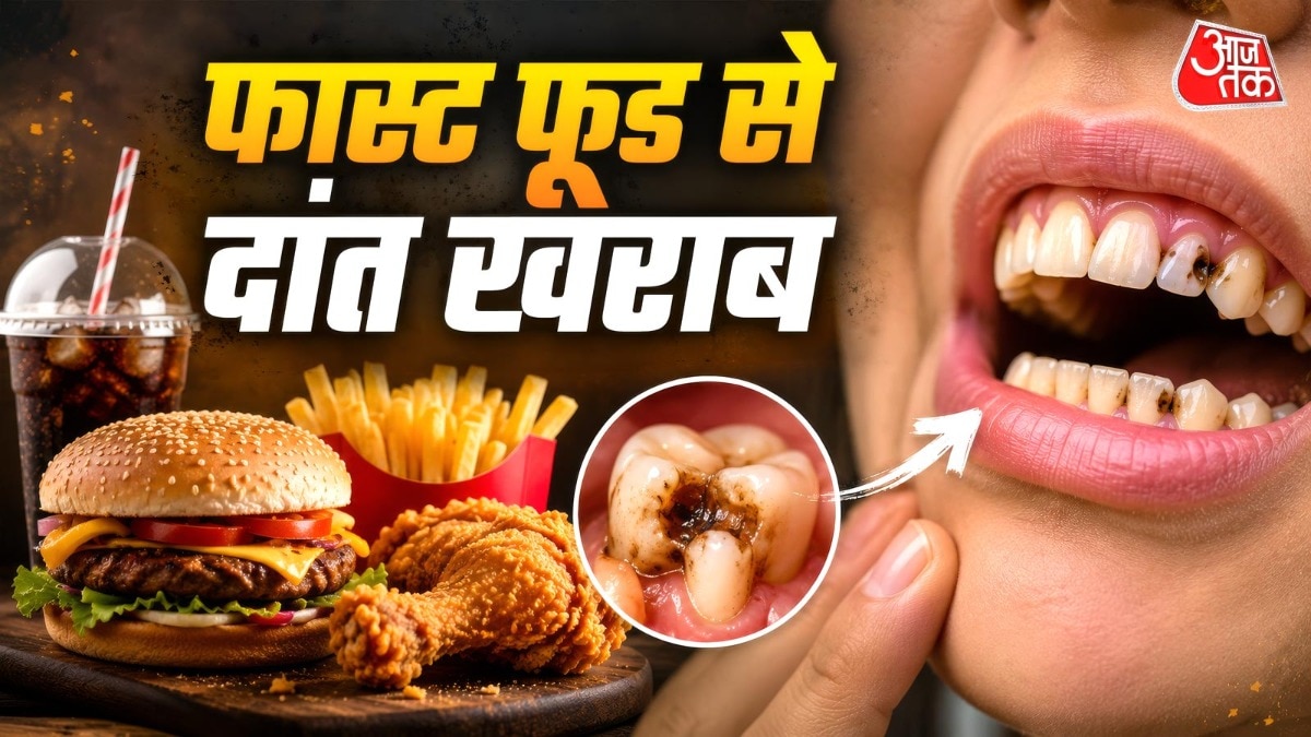 फास्ट फूड और ओरल हेल्थ